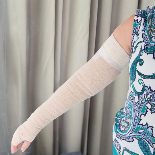 Compression sleeve for lymphoedema of the arm